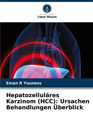 Hepatozelluläres Karzinom (HCC): Ursachen Behandlungen Überblick