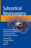 Subcortical Neurosurgery