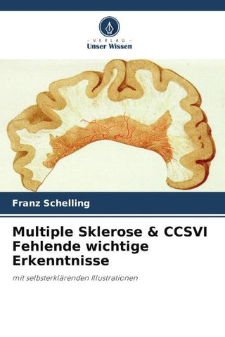 Multiple Sklerose & CCSVI Fehlende wichtige Erkenntnisse