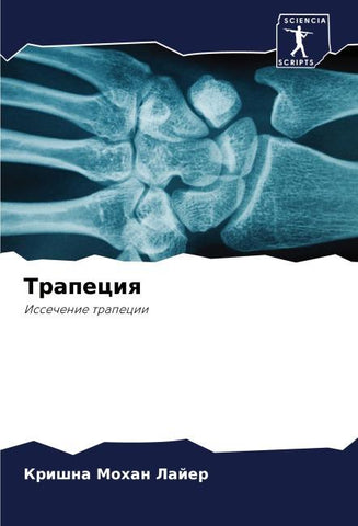 Trapeciq