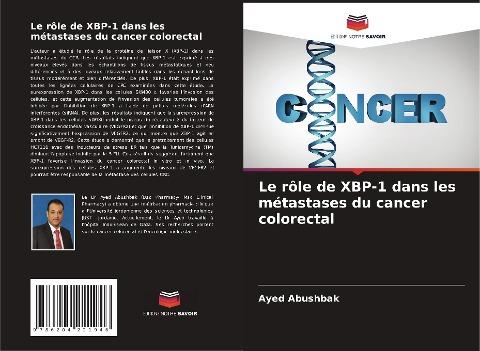 Le rôle de XBP-1 dans les métastases du cancer colorectal