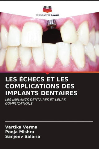 LES ÉCHECS ET LES COMPLICATIONS DES IMPLANTS DENTAIRES