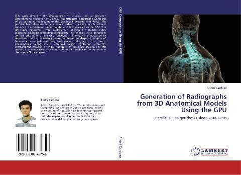 Generation of Radiographs from 3D Anatomical Models Using the GPU