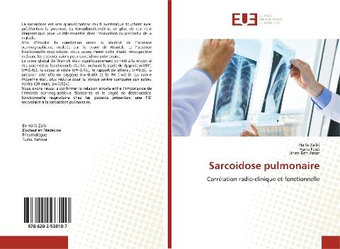 Sarcoidose pulmonaire