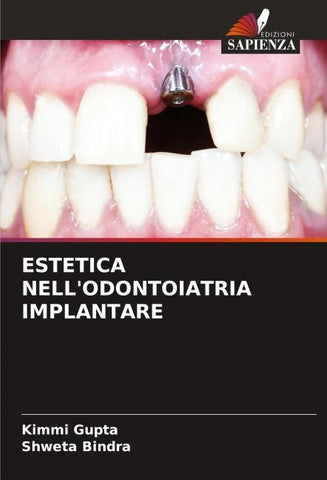 ESTETICA NELL'ODONTOIATRIA IMPLANTARE