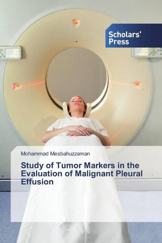 Study of Tumor Markers in the Evaluation of Malignant Pleural Effusion
