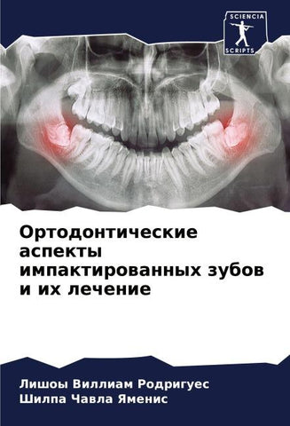 Ortodonticheskie aspekty impaktirowannyh zubow i ih lechenie