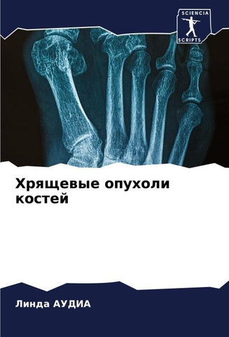 Hrqschewye opuholi kostej