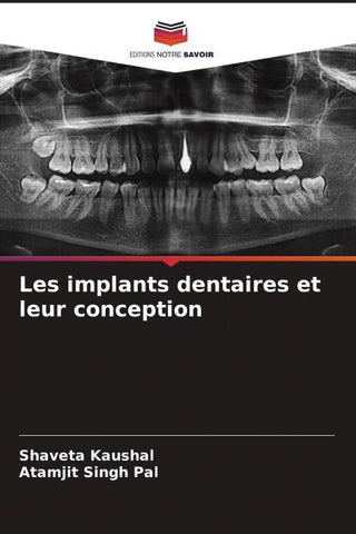 Les implants dentaires et leur conception