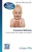 Cesarean Delivery