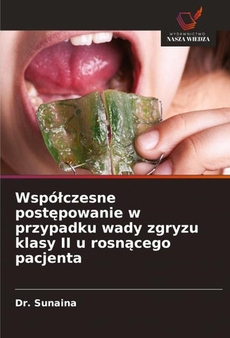Wspó¿czesne post¿powanie w przypadku wady zgryzu klasy II u rosn¿cego pacjenta