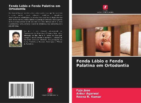 Fenda Lábio e Fenda Palatina em Ortodontia