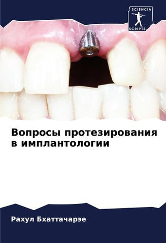 Voprosy protezirowaniq w implantologii