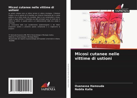 Micosi cutanee nelle vittime di ustioni