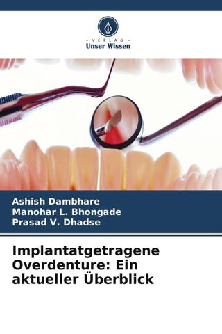 Implantatgetragene Overdenture: Ein aktueller Überblick