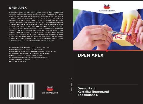 OPEN APEX