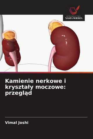 Kamienie nerkowe i kryszta¿y moczowe: przegl¿d