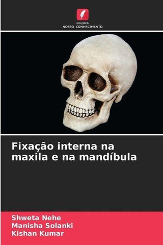 Fixação interna na maxila e na mandíbula