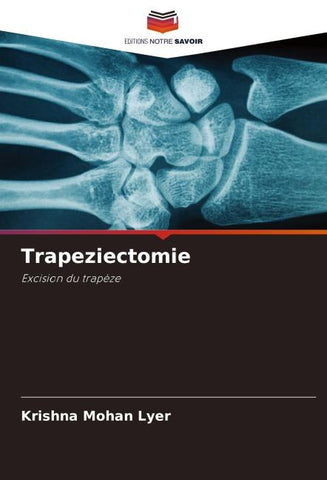 Trapeziectomie