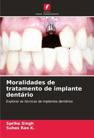 Moralidades de tratamento de implante dentário