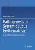 Pathogenesis of Systemic Lupus Erythematosus