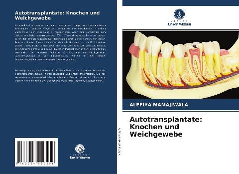 Autotransplantate: Knochen und Weichgewebe