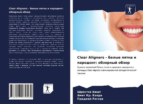 Clear Aligners - belye pqtna i parodont: obzornyj obzor