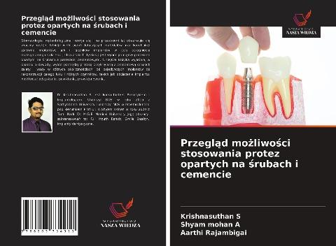 Przegl¿d mo¿liwo¿ci stosowania protez opartych na ¿rubach i cemencie