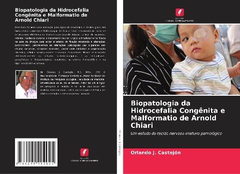 Biopatologia da Hidrocefalia Congênita e Malformatio de Arnold Chiari