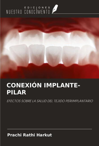 CONEXIÓN IMPLANTE-PILAR