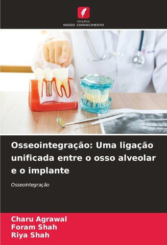 Osseointegração: Uma ligação unificada entre o osso alveolar e o implante