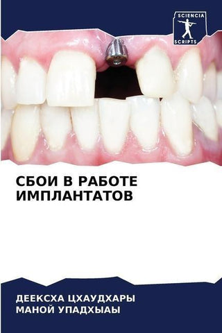 SBOI V RABOTE IMPLANTATOV
