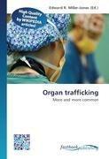Organ trafficking