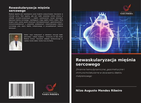 Rewaskularyzacja mi¿¿nia sercowego
