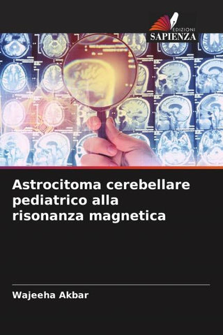 Astrocitoma cerebellare pediatrico alla risonanza magnetica
