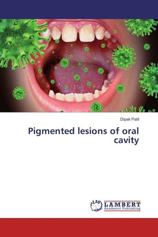 Pigmented lesions of oral cavity