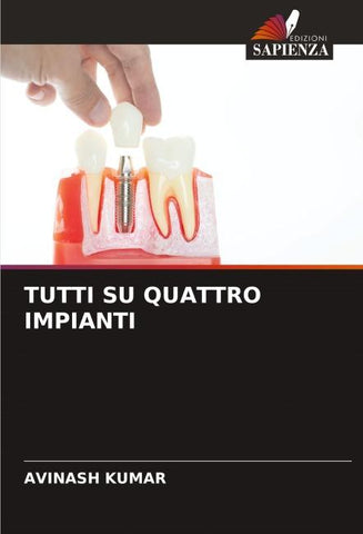 TUTTI SU QUATTRO IMPIANTI