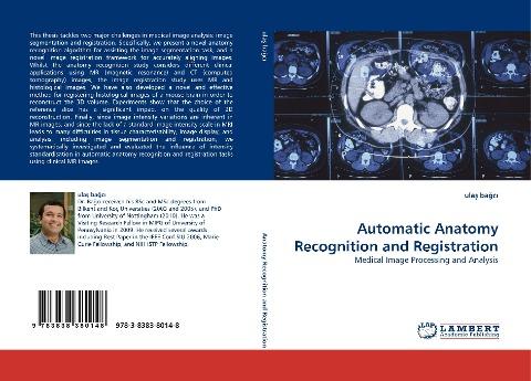 Automatic Anatomy Recognition and Registration