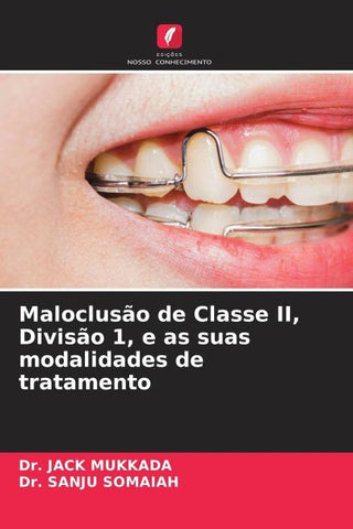 Maloclusão de Classe II, Divisão 1, e as suas modalidades de tratamento
