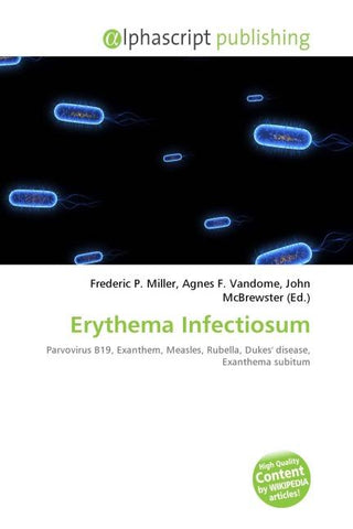 Erythema Infectiosum