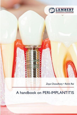 A handbook on PERI-IMPLANTITIS