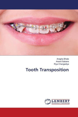 Tooth Transposition