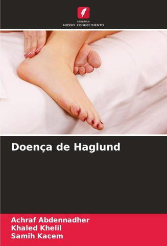 Doença de Haglund