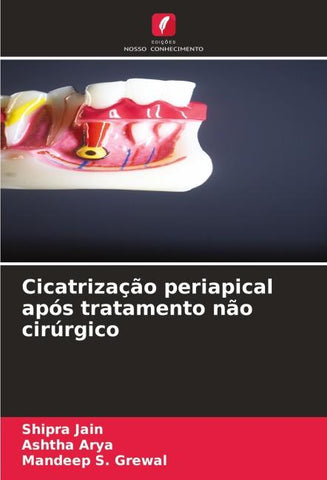 Cicatrização periapical após tratamento não cirúrgico
