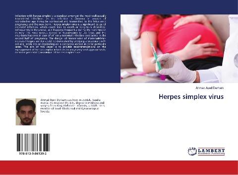 Herpes simplex virus