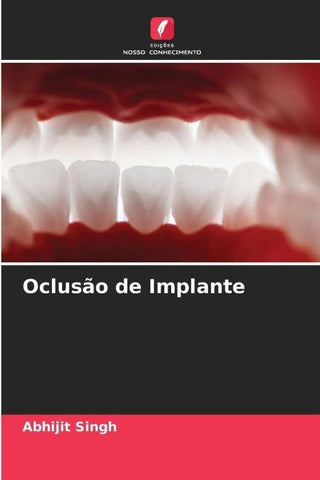Oclusão de Implante
