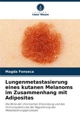 Lungenmetastasierung eines kutanen Melanoms im Zusammenhang mit Adipositas