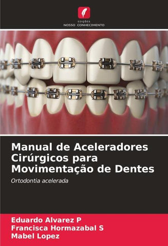 Manual de Aceleradores Cirúrgicos para Movimentação de Dentes