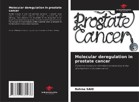 Molecular deregulation in prostate cancer