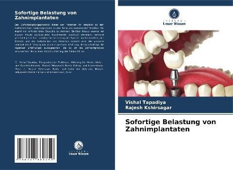 Sofortige Belastung von Zahnimplantaten
